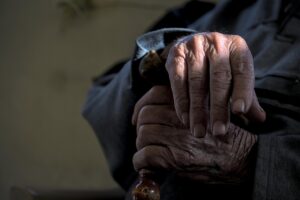 まつ毛が老化が進む原因とは何ですか？